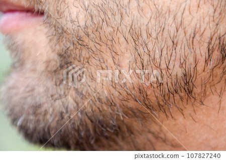 Bearded male chin. Beard on the face of a young man. Bearded male chin. Beard on the face of a young man. 107827240
