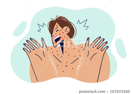 Frightened woman with allergic rash on face and body screams, needing doctor help 107835880