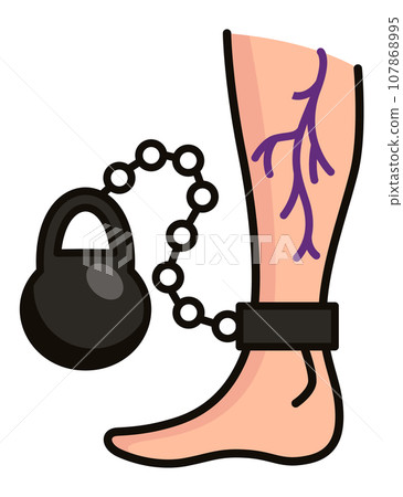 Varicose treatment icon. Violation of circulatory system. Vascular disease diagnostic. Venous insufficiency medical disease. Vector illustration Varicose treatment icon. Violation of circulatory system. Vascular disease diagnostic. Venous insufficiency medical disease. Vector illustration 107868995
