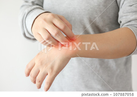 Young asian woman itching and scratching on arm from itchy dry skin eczema dermatitis 107887058