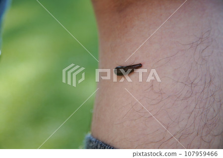 How a leech sucks blood 107959466