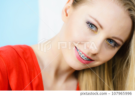 Woman showing her teeth with braces Woman showing her teeth with braces 107965996