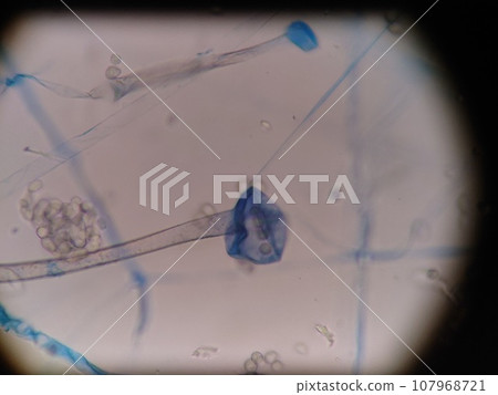 Mold spore shell with spores removed 107968721