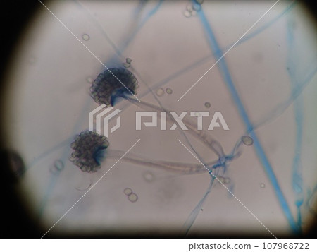 可以觀察到根莖的根黴 107968722