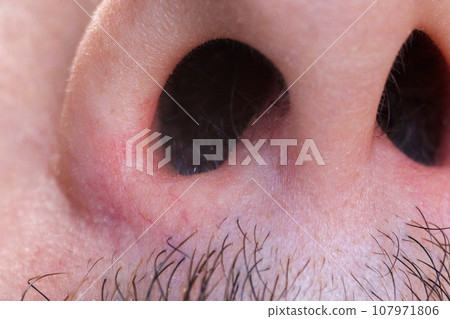 Nose hair men close up. A man plucks a hair from his nose, macro. Selective focus 107971806