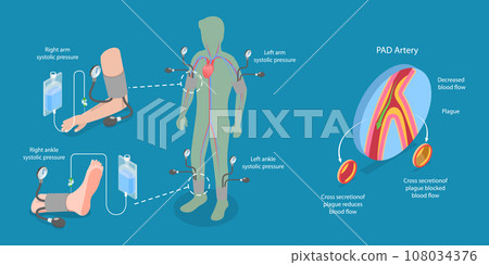 3D Isometric Flat Vector Illustration of ABI Test 3D Isometric Flat Vector Illustration of ABI Test 108034376