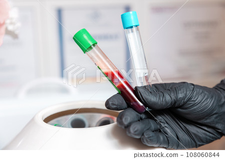 Plasmolifting. Preparation of blood for beauty injections. Cosmetologist holds two vials in hands - with blood and an empty one. Close up. The concept of medical test and biochemistry Plasmolifting. Preparation of blood for beauty injections. Cosmetologist holds two vials in hands - with blood and an empty one. Close up. The concept of medical test and biochemistry 108060844
