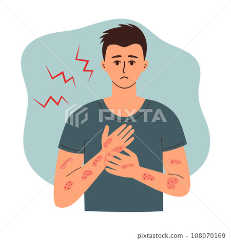 Sad man suffering from psoriasis, eczema or dermatitis scratches rashes on his hand. Skincare, medicine and healthcare concept. 108070169
