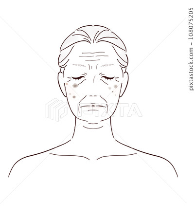 Illustration of skin problems as you age Illustration of skin problems as you age 108075205