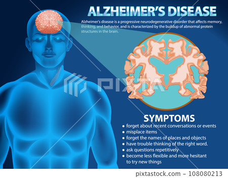 Informative poster of Alzheimers disease Informative poster of Alzheimers disease 108080213