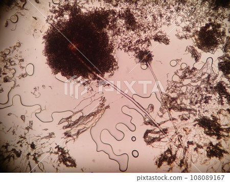 顯微鏡下觀察黑黴菌孢子的差異 108089167