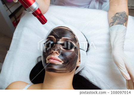Close-up of cosmetologist's hand making hardware carbon peeling by young pretty customer woman in safety glasses headdress lying on couch in beauty salon. Facial cleaning concept. Cosmetology Services Close-up of cosmetologist's hand making hardware carbon peeling by young pretty customer woman in safety glasses headdress lying on couch in beauty salon. Facial cleaning concept. Cosmetology Services 108097014