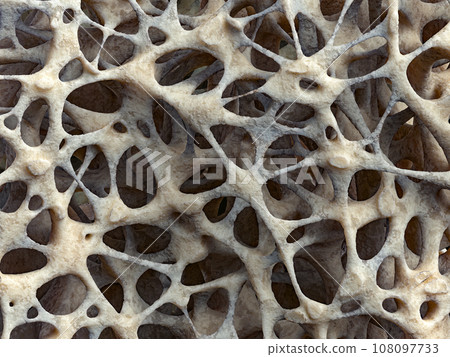 Realistic bone spongy structure close-up, bone texture affected by osteoporosis Realistic bone spongy structure close-up, bone texture affected by osteoporosis 108097733