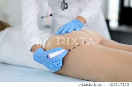 Doctor draws marks on the patient's buttocks with marker for body shaping Doctor draws marks on the patient's buttocks with marker for body shaping 108117130