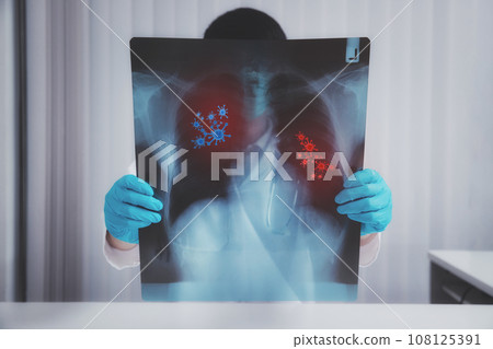 A doctor is diagnosing the results of the lung X-rays of patients infected with the coronavirus. A doctor is diagnosing the results of the lung X-rays of patients infected with the coronavirus. 108125391