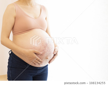 Pregnant woman putting her hand on her stomach with stretch marks and midline 108134255