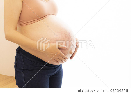 Pregnant woman putting her hand on her stomach with stretch marks and midline 108134256
