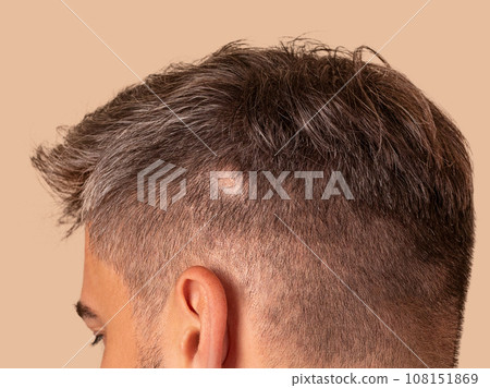 man with alopecia close up photo man with alopecia close up photo 108151869