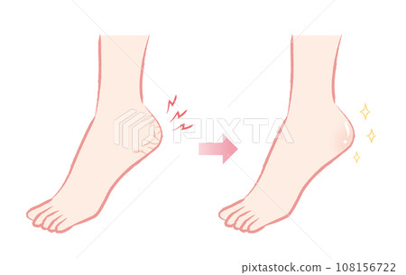 粗高跟,光滑高跟,之前和之後的插圖 粗高跟,光滑高跟,之前和之後的插圖 108156722