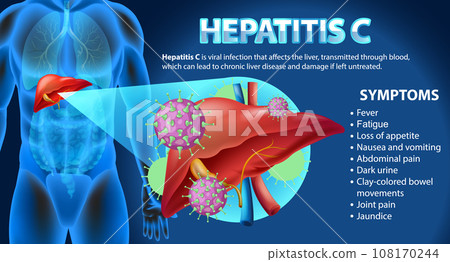 Informative Symptoms of Hepatitis C 108170244