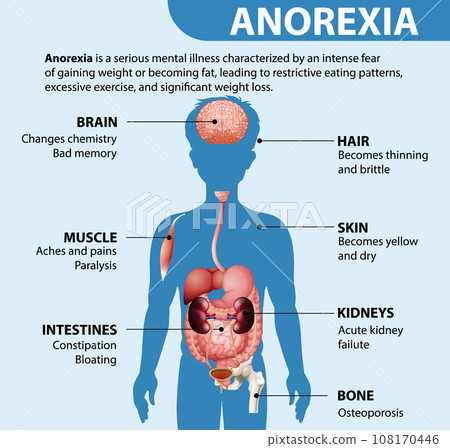 Effects of Anorexia on Male Anatomy Effects of Anorexia on Male Anatomy 108170446