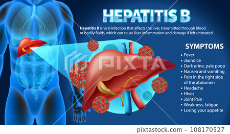Symptoms of Hepatitis B Infographic 108170527