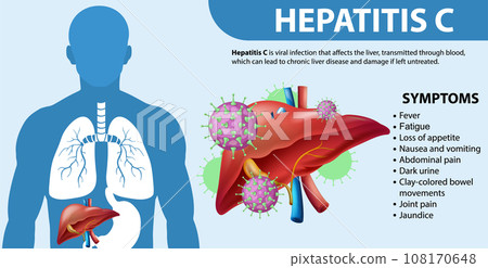 Informative Symptoms of Hepatitis C 108170648