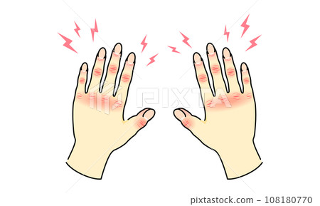 Rough hands with lines on both hands 2 108180770