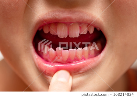 孩子的嘴巴被染色了 孩子的嘴巴被染色了 108214824