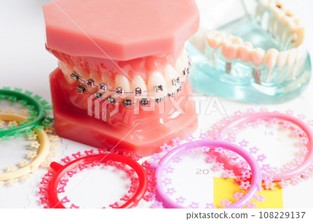 Orthodontic ligatures rings and ties, elastic rubber bands on orthodontic braces, model for dentist studying about dentistry. 108229137