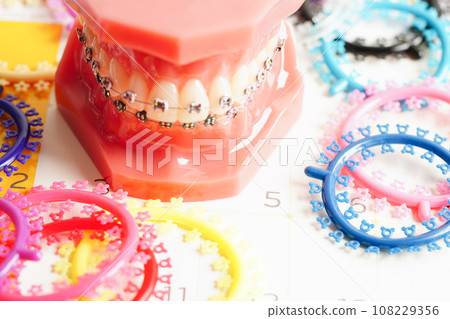 Orthodontic ligatures rings and ties, elastic rubber bands on orthodontic braces, model for dentist studying about dentistry. 108229356