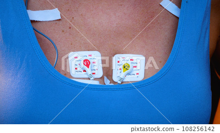 Unrecognizable woman with a device for daily monitoring of heart function on her chest. Halter. 108256142