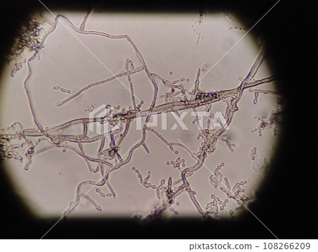 Growing mold hyphae seen under a microscope 108266209