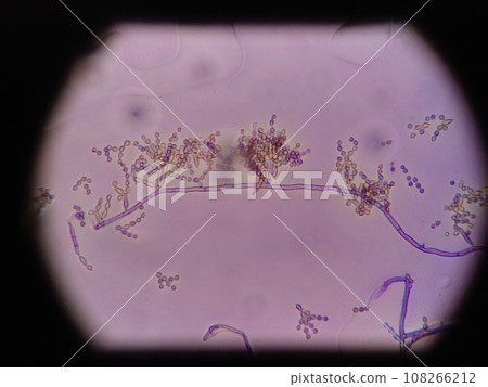 A microscopic photo that clearly shows the septation walls of hyphae. A microscopic photo that clearly shows the septation walls of hyphae. 108266212