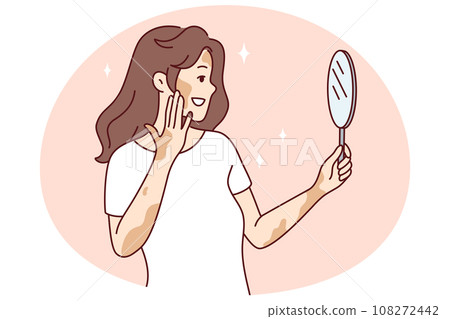 Woman with vitiligo look in mirror 108272442
