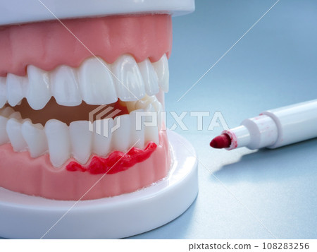 Dental plastic jaw marked with a marker as gum disease concept. Dental plastic jaw marked with a marker as gum disease concept. 108283256