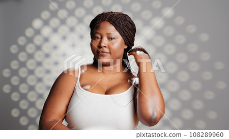 African american woman embracing imperfections and posing with bare skin, creating body prositivity and skincare campaign. Young beautiful adult promoting beauty products and self love. 108289960