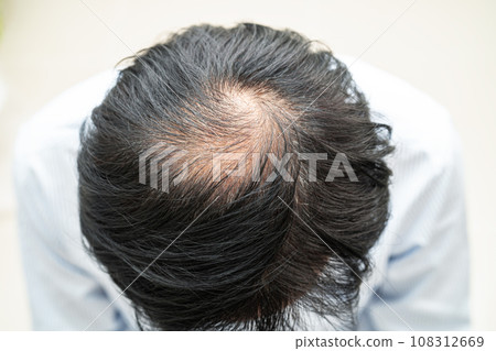 Bald in the middle head and begin no loss hair glabrous of mature Asian business smart active office man. Bald in the middle head and begin no loss hair glabrous of mature Asian business smart active office man. 108312669