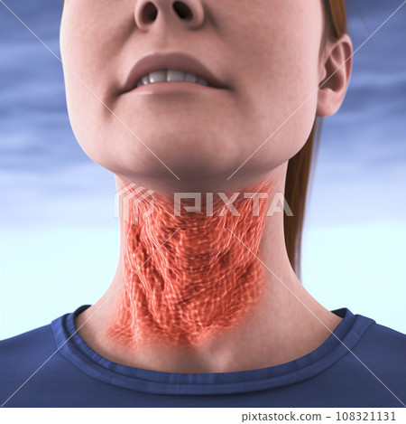 Sore throat, sore throat, pharyngitis, illness, cold, infection, red sore throat close-up, medical background 108321131