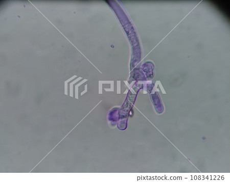 豆豉真菌孢子生長的地方 豆豉真菌孢子生長的地方 108341226
