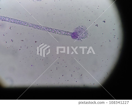 tempeh fungus spores tempeh fungus spores 108341227