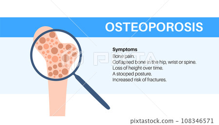 Osteoporosis medical poster 108346571