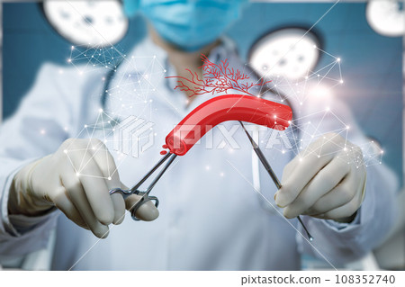 Concept of treating blood vessels surgically. Concept of treating blood vessels surgically. 108352740