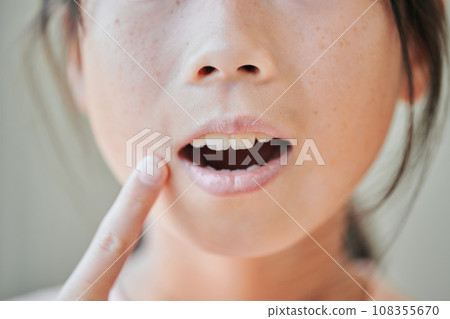 四年級女孩的牙齒 108355670