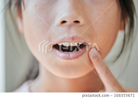 4th grade girl's teeth 108355671