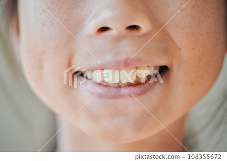 4th grade girl's teeth 4th grade girl's teeth 108355672