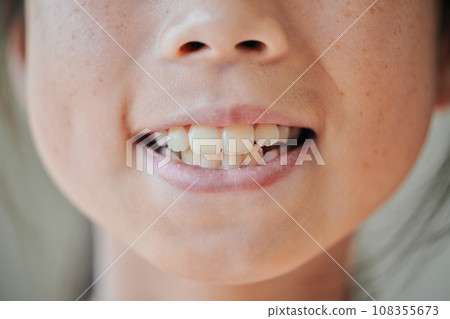 四年級女孩的牙齒 108355673