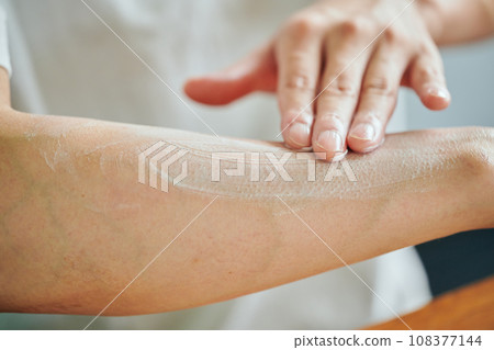 Young man applying cream on his arm Young man applying cream on his arm 108377144
