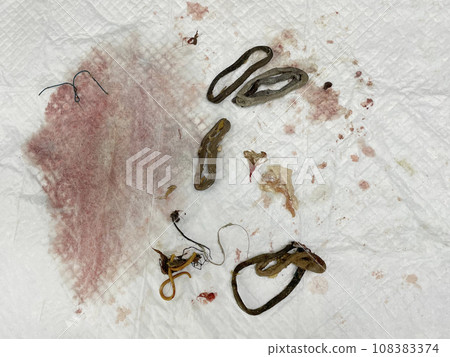 Things from the stomach and intestines after vet Intestinal Obstruction surgery Things from the stomach and intestines after vet Intestinal Obstruction surgery 108383374