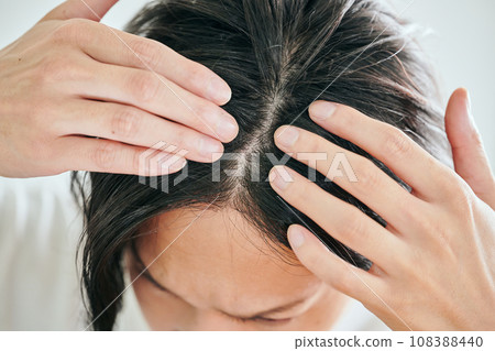 A young man who is concerned about hair loss 108388440